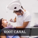 Root Canal A Helpful Guide