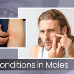 males skin problem